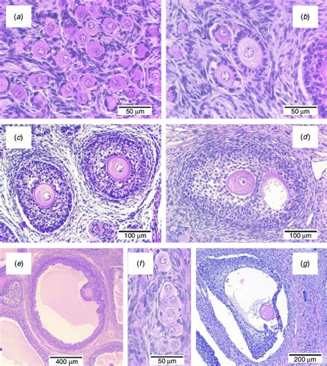 Atretic Follicle Histology