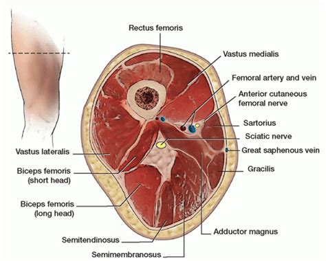 Ultrasound-Guided Adductor Canal Block | Anesthesia Key