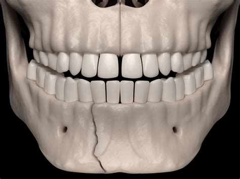 Facial Trauma » Minneapolis Oral Surgeons » Minnesota Oral & Facial Surgery