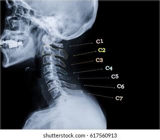 966 C Spine Images, Stock Photos & Vectors | Shutterstock