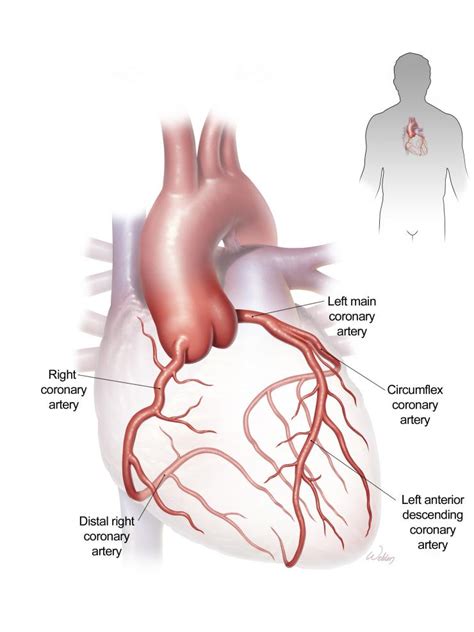 Coronary Artery Disease and Coronary Bypass Surgery