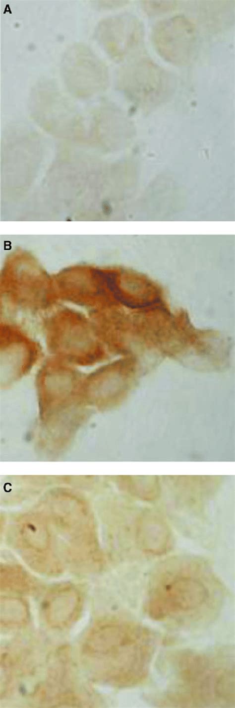 (A) Histological image of bulbar conjunctival cells in a normal eye.... | Download Scientific ...