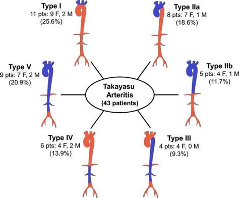 What Is Takayasu's Arteritis? Takayasu's arteritis is an - MEDizzy