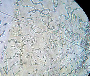 Cyanobacteria