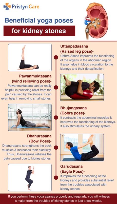 Benefits Of Yoga For Kidney Stones