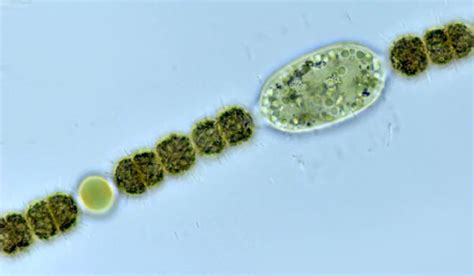 Phytoplankton key - Phycokey - Anabaena images | Prokaryotic cell, Spore, Microscopic images