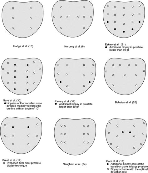 Template Prostate Biopsy