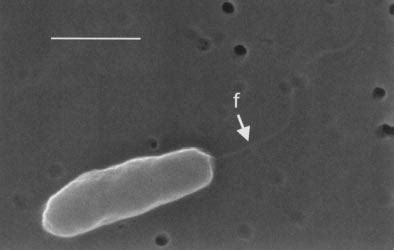 Scanning electron micrograph of strain MV1075 T , showing the flagellum... | Download Scientific ...