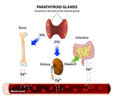 Hyperactive Parathyroid May Trouble Women with Fibromyalgia, Study Reports - Fibromyalgia News Today