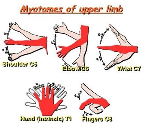 Myotomes of upper hand | Physical therapy student, Limb, Nerve anatomy