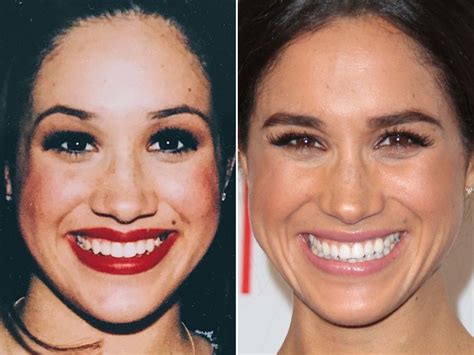 Meghan Markle Before and After: From 1990s to 2020 - The Skincare Edit