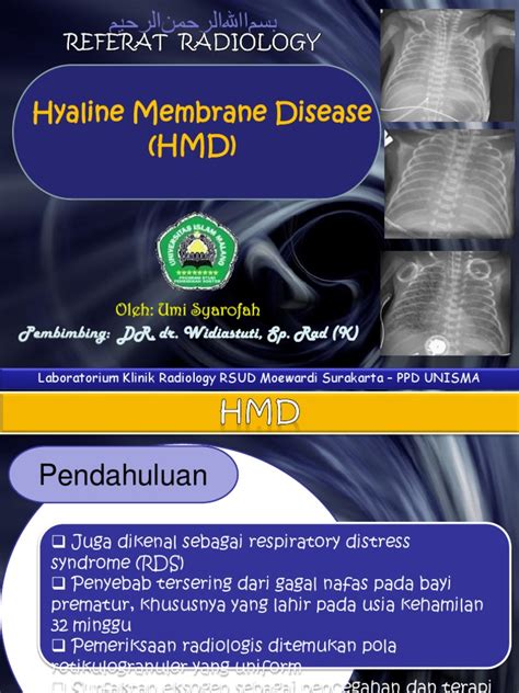 Hyaline Membrane Disease