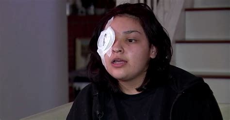 Hero Teen Loses Eye In Brutal Assault For Defending Boy With Special Needs | FaithPot