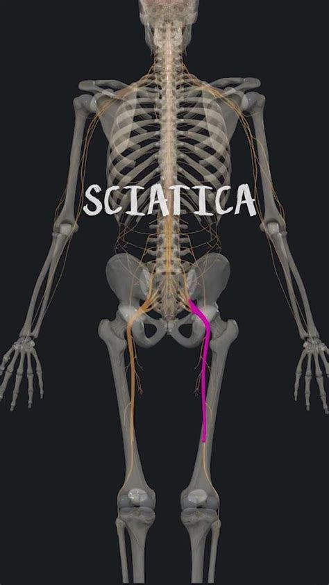 Sciatic Pain How To Massage [Video] in 2024 | Sciatic nerve pain, Sciatic nerve, Massage techniques