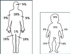 Total Body Surface Area illustration of the Rule of Nine, adult and child diagrams | I'm a nurse ...