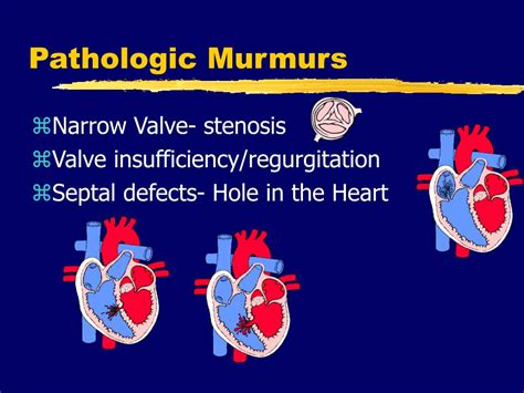 PPT - Heart Murmurs & Valvular Heart Disease PowerPoint Presentation ...