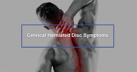 Cervical Herniated Disc Symptoms - Dr. Kevin Pauza, The Discseel® Procedure inventor