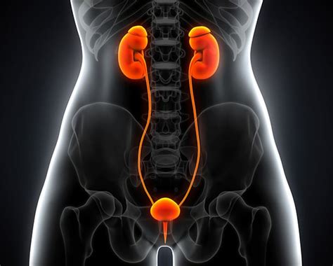 Kidney Cysts - Urologist | UC Irvine Department of Urology