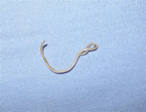 File:Canine roundworm 1.JPG - Wikimedia Commons