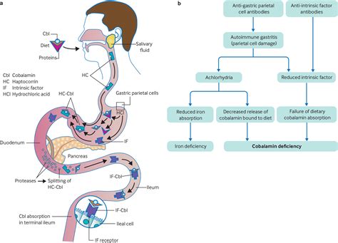 Pernicious anaemia | The BMJ