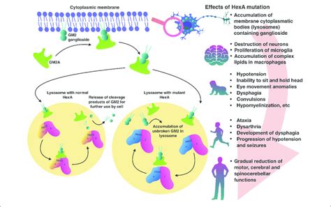 | Pathogenesis of Tay-Sachs disease. | Download Scientific Diagram