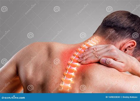 Pain in the Cervical Spine. Symptom of Cervical Chondrosis Stock Photo ...