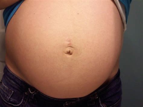 UGLY belly buttons! - BabyCenter