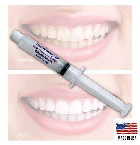 Always White 6 Professional 44% Carbamide Peroxide Teeth Whitening Gel Kit - USA - Whitening