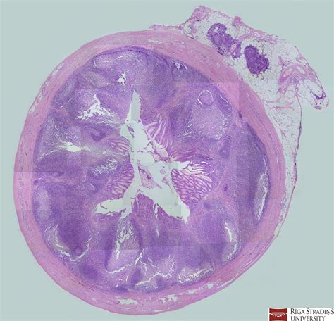 Appendix vermiformis structures Diagram | Quizlet