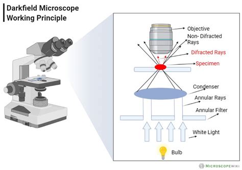 Dark field microscope - Diagram (Parts), Principle, Applications, Price, Advantages, Disadvantages