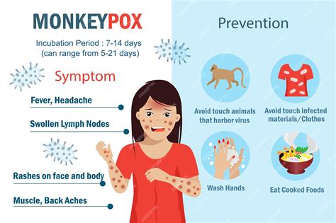 Premium Vector | Monkeypox virus symptoms and prevention infographic ...