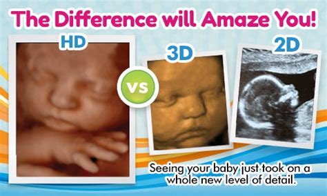 Significance of Ultrasounds at Different Stages of Pregnancy | by ...