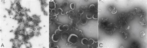 Uranyl acetate negative stained transmission electron m | Open-i