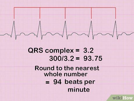 3 Ways to Calculate Heart Rate from ECG - wikiHow