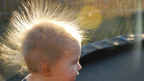 Uncombable Hair Syndrome Is a Rare, Genetic Syndrome — and This Little ...