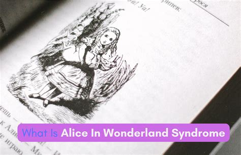 What Is Alice in Wonderland Syndrome (AWS)? Causes, Symptoms And ...