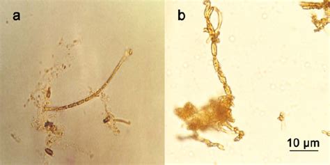 Light microscopic images of (a) Leptothrix structures from site 2a... | Download Scientific Diagram