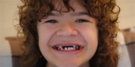 Gaten Matarazzo's Teeth: Whats Happened to Them? | Techie + Gamers