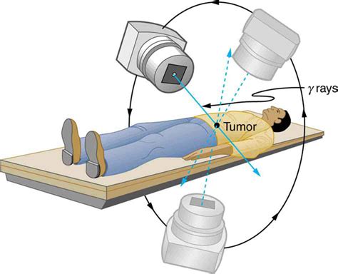 Therapeutic Uses of Ionizing Radiation | Physics