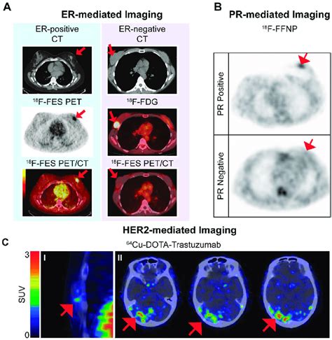 Examples of images using the estrogen receptor (ER)-targeted... | Download Scientific Diagram