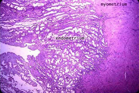 Uterus Histology Myometrium