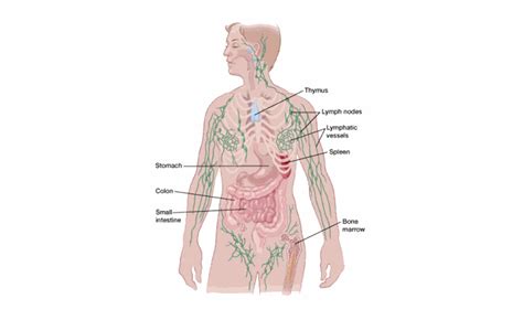 Stage 4 Cancer Lymph Nodes: Symptoms, Diagnosis, Treatment