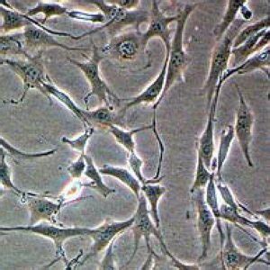 Red Fluorescent NIH/3T3 Cell Line - Innoprot Stable Cell Lines