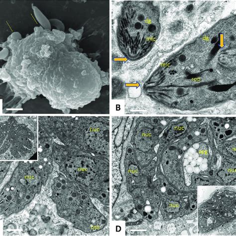 Scanning and transmission electron microscopy of tachyzoites. (A)... | Download Scientific Diagram