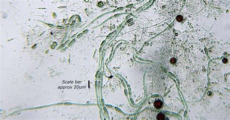 Scientists discover a bacteria that could help humans breathe on Mars - Tech Startups