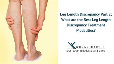 The Best Leg Length Discrepancy Treatment Modalities!