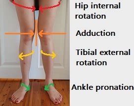 How To Fix Knee Valgus - Posture Direct