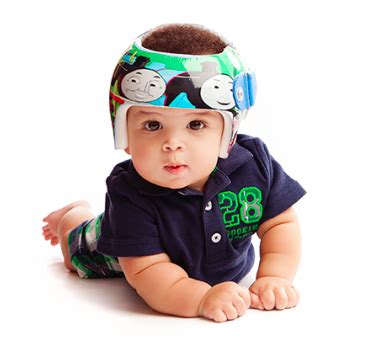 Plagiocephaly Helmets - BIODESIGN PROSTHETICS & ORTHOTICS