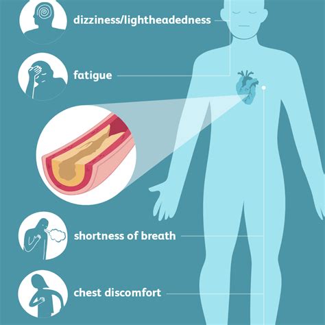 How Do Coronary Heart Disease Affect The Body - Gallery