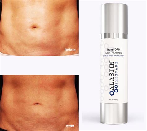 Alastin Skincare TransFORM Body Treatment: Body-Sculpting